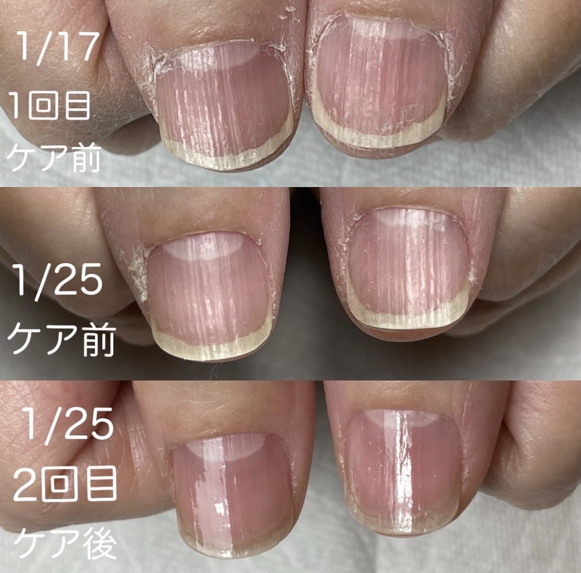 💅最強ネイルケア💅