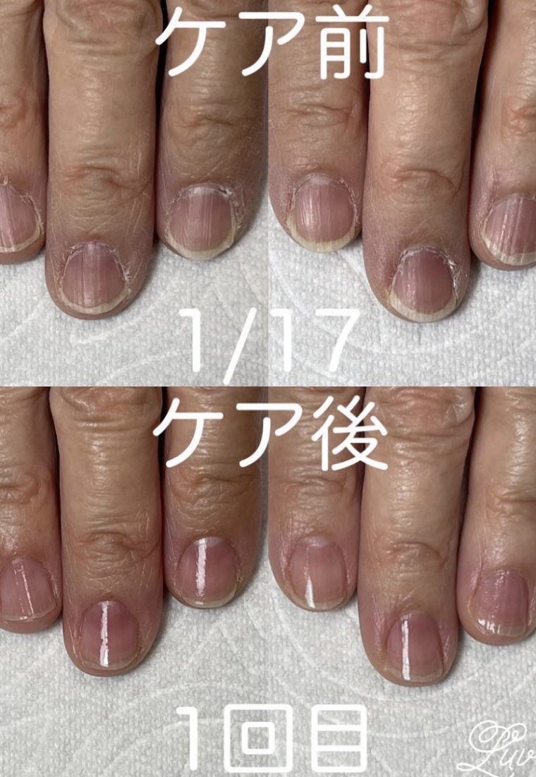 💅最強ネイルケア💅