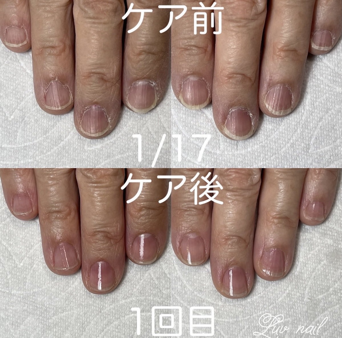 💅最強ネイルケア💅