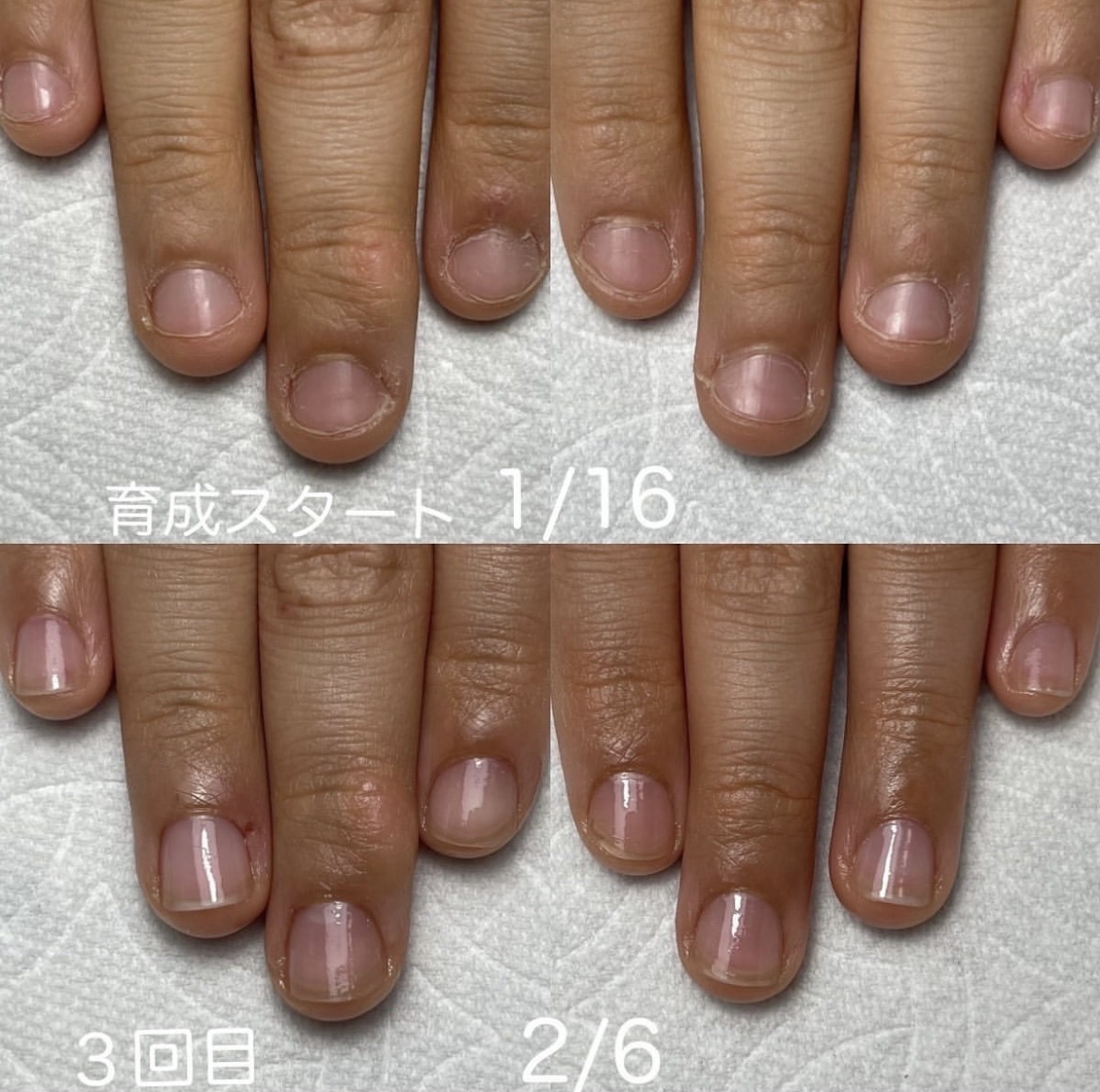 最強ネイルケアメソッドお客様 三田 神戸 兵庫 ネイルサロン ネイルケア 自爪育成 Luv Nail Beauty Official Site ラヴネイル