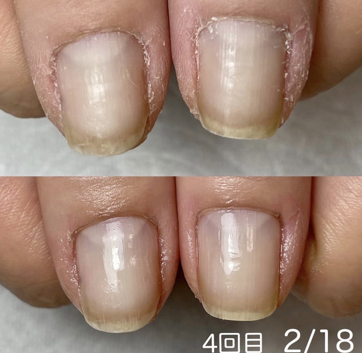 最強ネイルケアお客様💅